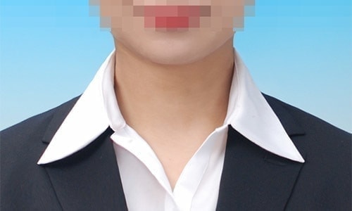 ゆがみ修整見本1