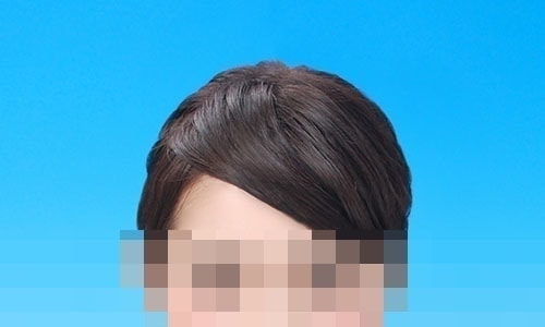 髪のはね消し見本